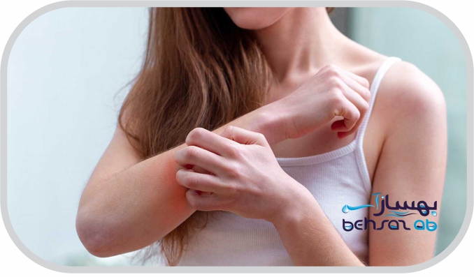 تاثیر تصفیه آب در خارش بعد از حمام