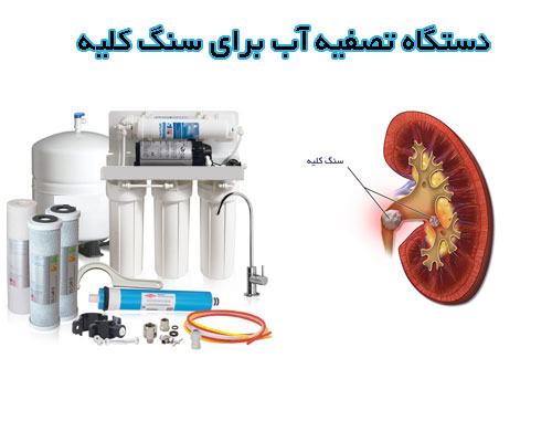 دستگاه تصفیه آب برای سنگ کلیه
