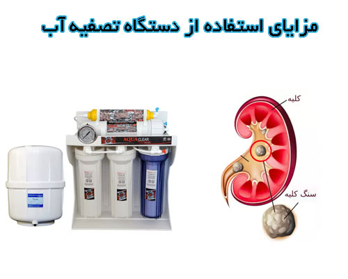 مزایای استفاده از دستگاه تصفیه آب برای جلوگیری از سنگ کلیه